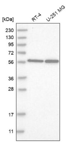 hHR23b Antibody, Novus Biologicals 0.1mL; Unlabeled:Antibodies, Polyclonal